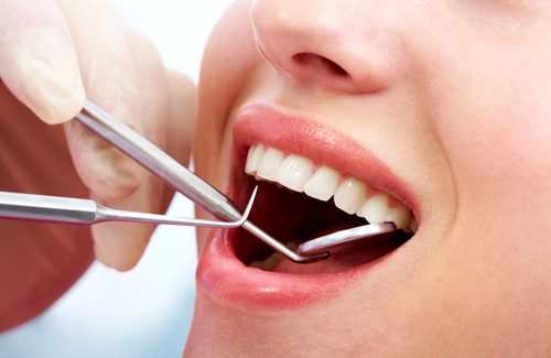 Is it necessary to have dental Checkups?