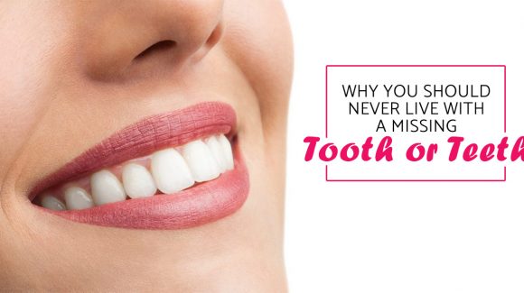 Why you should never live with a missing tooth or teeth