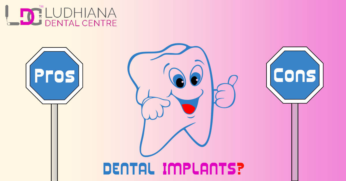 What Are The Pros And Cons Of Dental Implants?