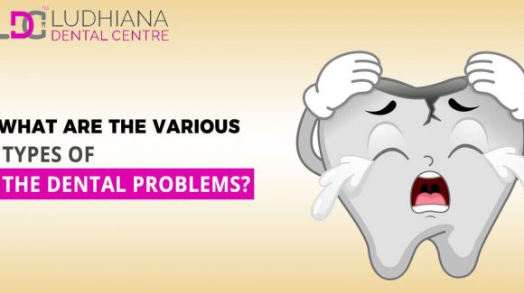 Which are the most common dental problems you should know about?