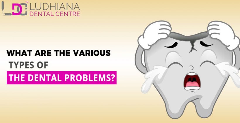 What Are The Various Types Of The Dental Problems?
