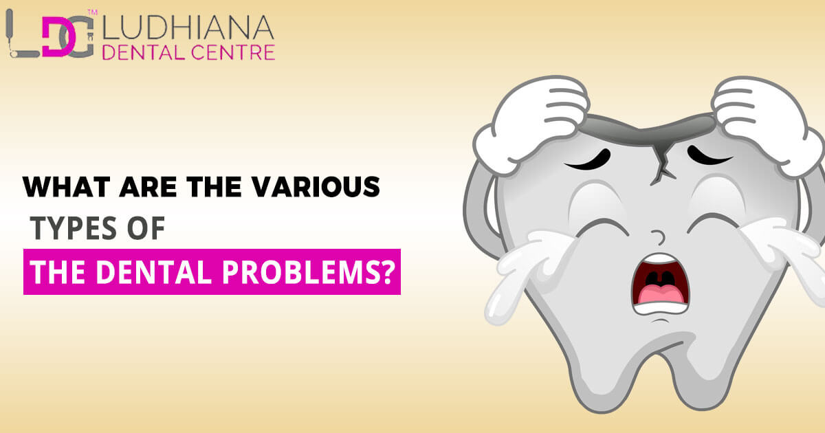 What Are The Various Types Of The Dental Problems?