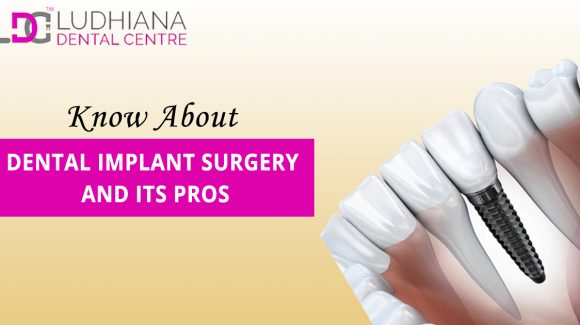 Dental Implant Surgery And Its Pros