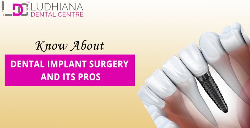 Dental Implant Surgery And Its Pros