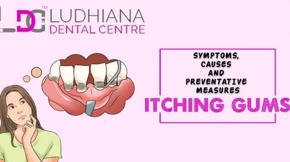 ITCHING GUMS-SYMPTOMS, CAUSES AND PREVENTATIVE MEASURES