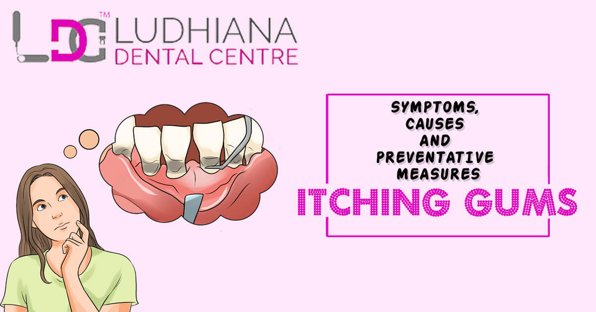 ITCHING GUMS-SYMPTOMS, CAUSES AND PREVENTATIVE MEASURES