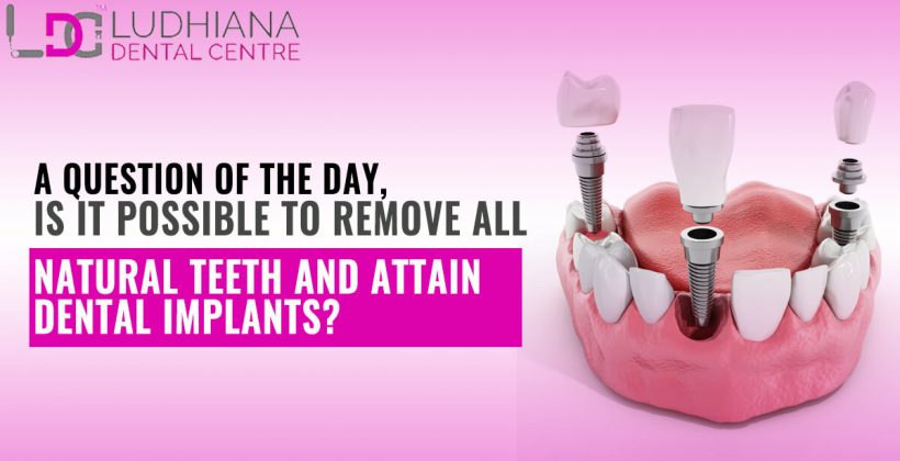 A question of the Day, Is it possible to remove all natural teeth and attain Dental Implants?
