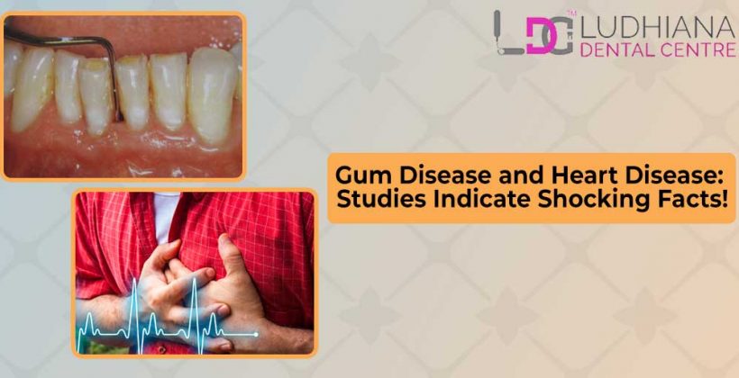 Gum Disease and Heart Disease: Studies Indicate Shocking Facts!