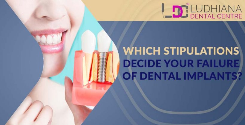 Which Stipulations Decide your Failure of Dental Implants?