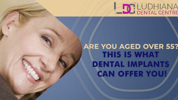 Are You Aged Over 55? This is What Dental Implants Can Offer You!