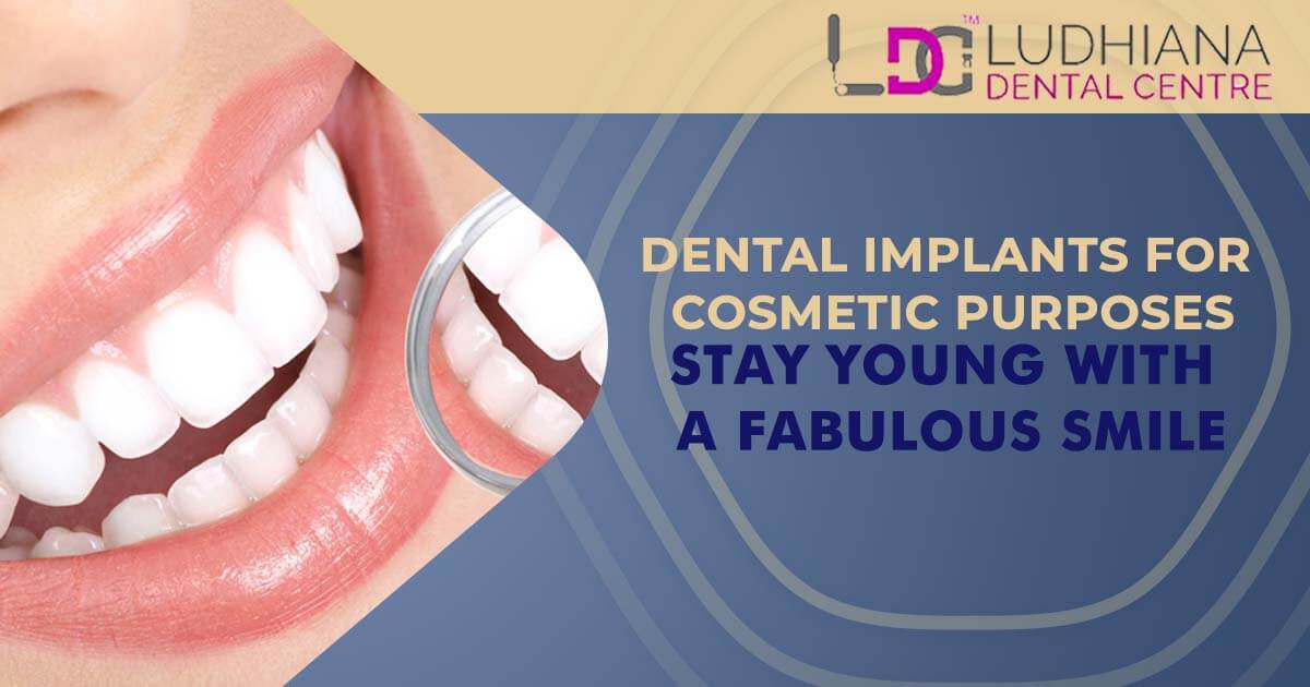 Dental Implants For Cosmetic Purposes- Stay Young With a Fabulous Smile