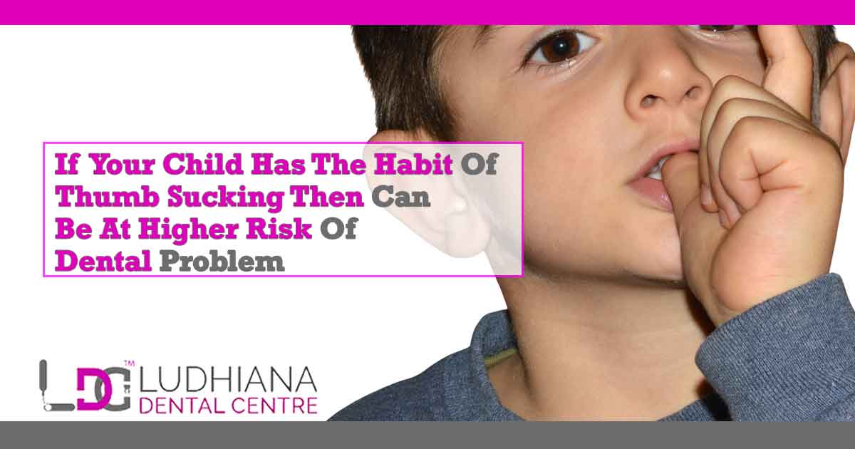 If your Child has the Habit of Thumb Sucking Then Can be at Higher Risk of Dental Problem