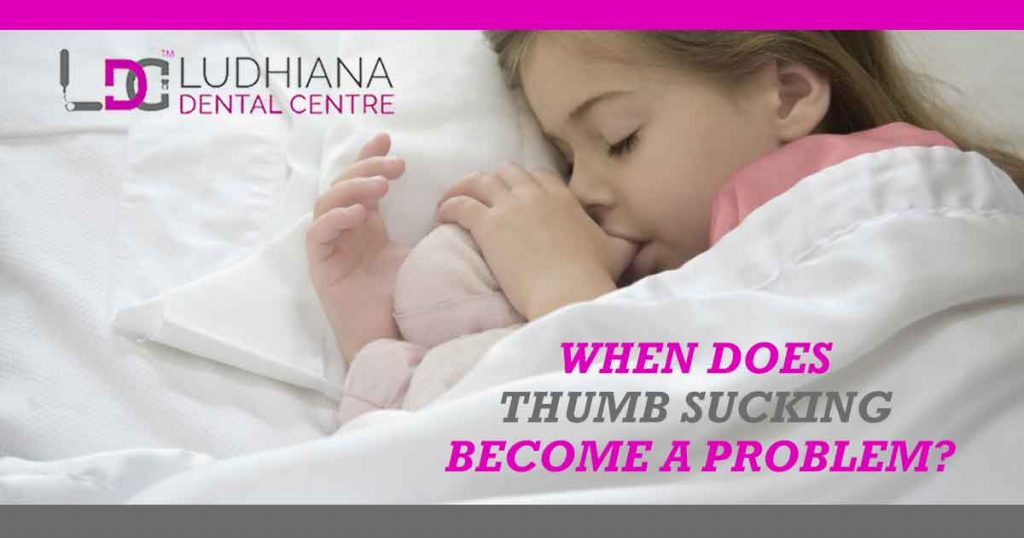 When does thumb sucking become a problem?