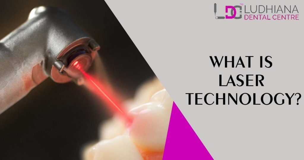 What is laser technology?