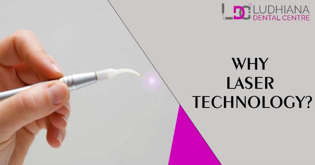 Why laser technology?