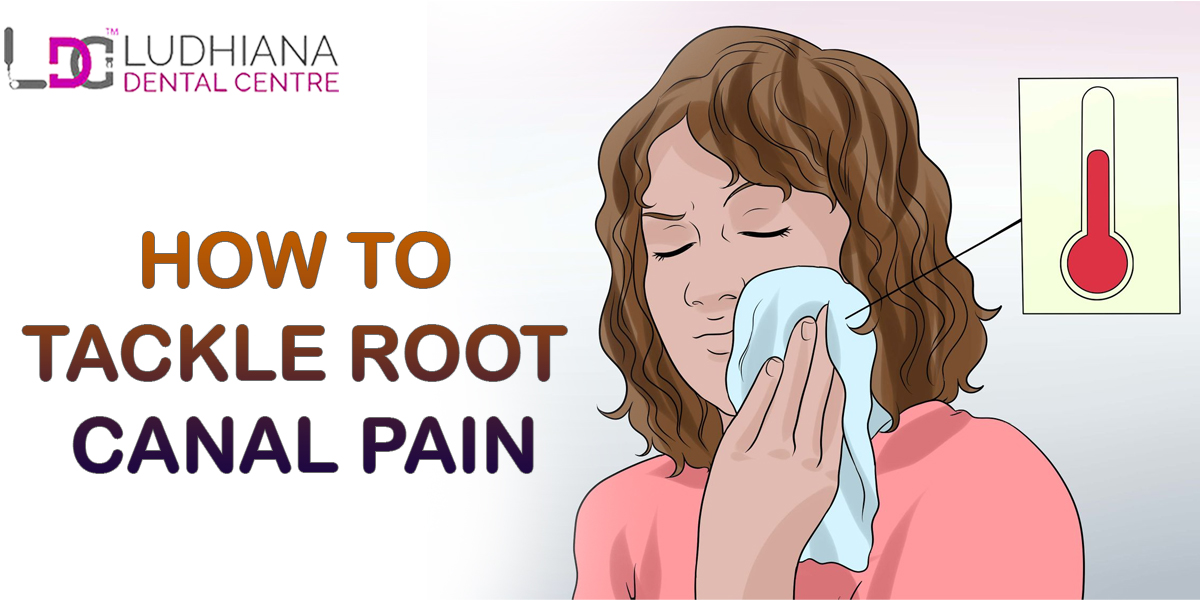 How To Tackle Root Canal Pain
