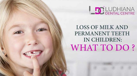 Loss Of Milk And Permanent Teeth In Children : What To Do?