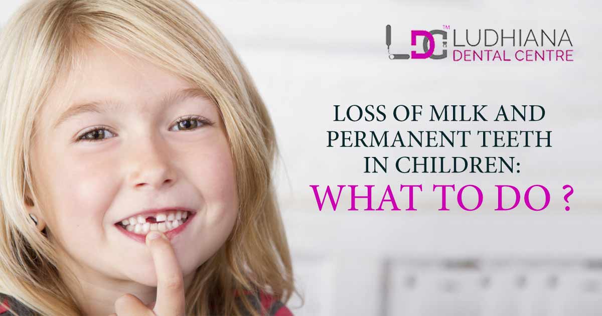 Loss Of Milk And Permanent Teeth In Children : What To Do?