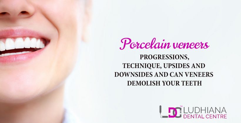 Porcelain Veneers Progressions, Technique, Upsides And Downsides And Can Veneers Demolish Your Teeth