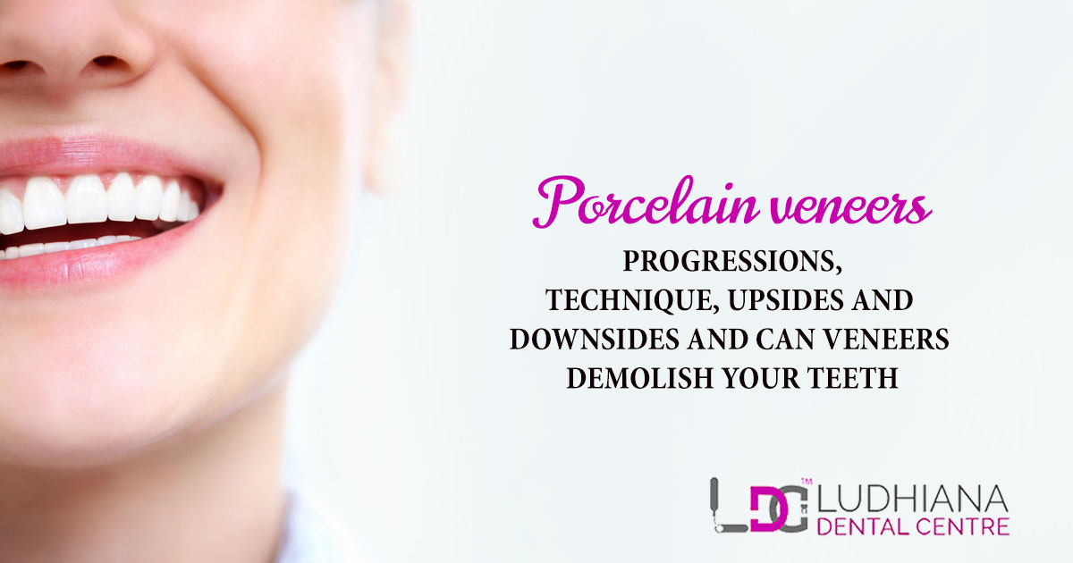 Porcelain Veneers Progressions, Technique, Upsides And Downsides And Can Veneers Demolish Your Teeth