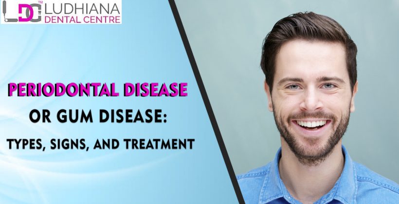 Periodontal Disease or Gum Disease: Types, Signs, and Treatment
