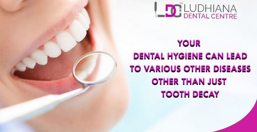 Your Dental Hygiene Can Lead To Various Other Diseases Other Than Just Tooth Decay