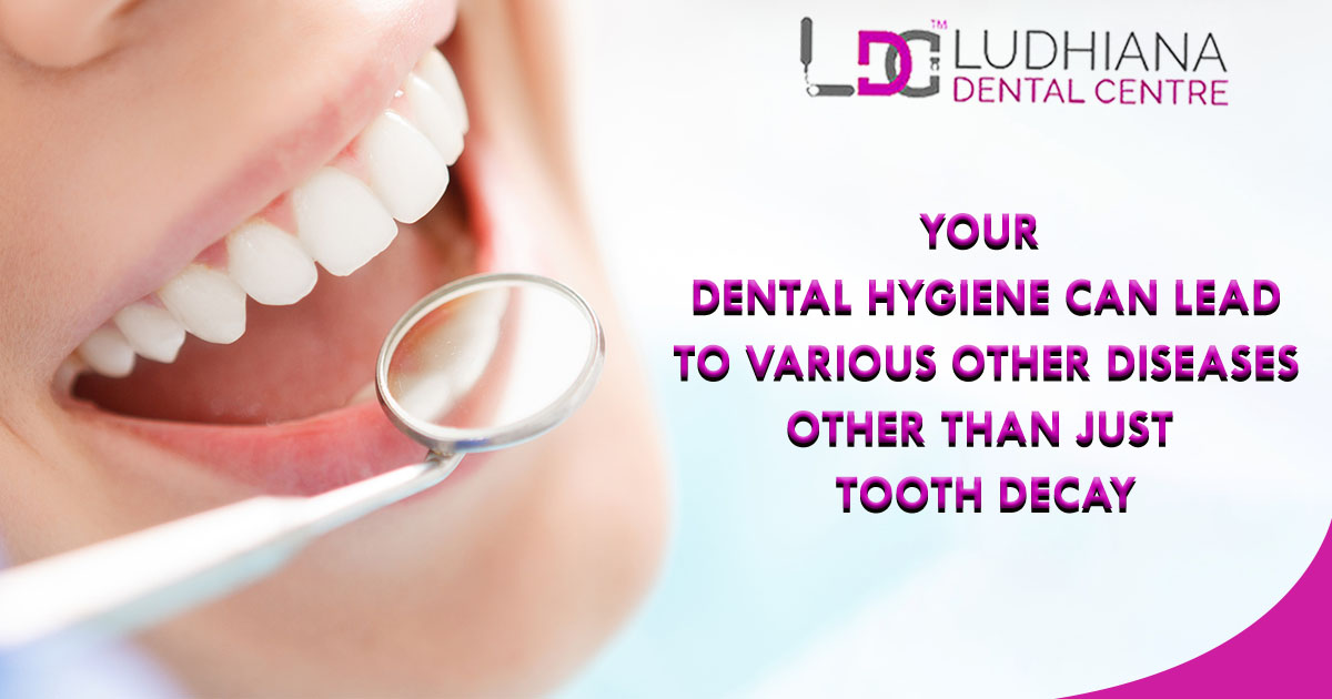 Your Dental Hygiene Can Lead To Various Other Diseases Other Than Just Tooth Decay