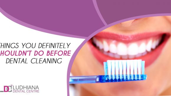 Things You Definitely Shouldn’t Do Before Dental Cleaning