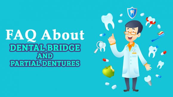 Dental Bridge: How many teeth are possible to replace with a dental bridge?
