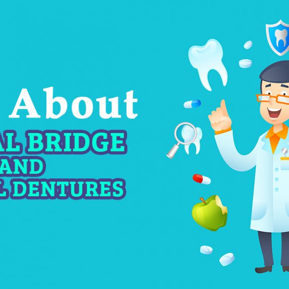Dental Bridge: How many teeth are possible to replace with a dental bridge?