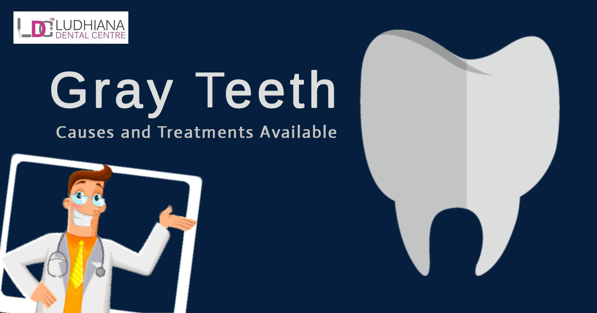 Gray Teeth: Causes and Treatments Available