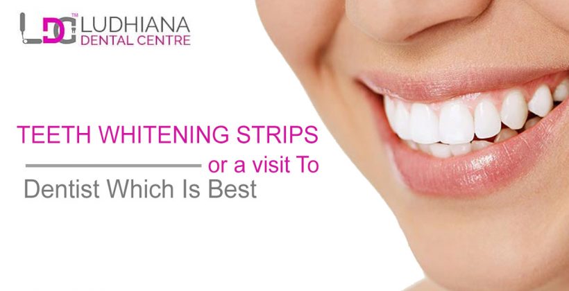 Teeth Whitening Strips Or A Visit To Dentist Which Is Best
