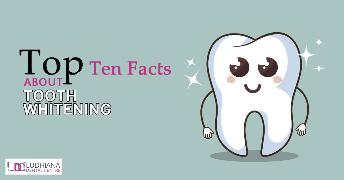 Top Ten Facts about Tooth Whitening