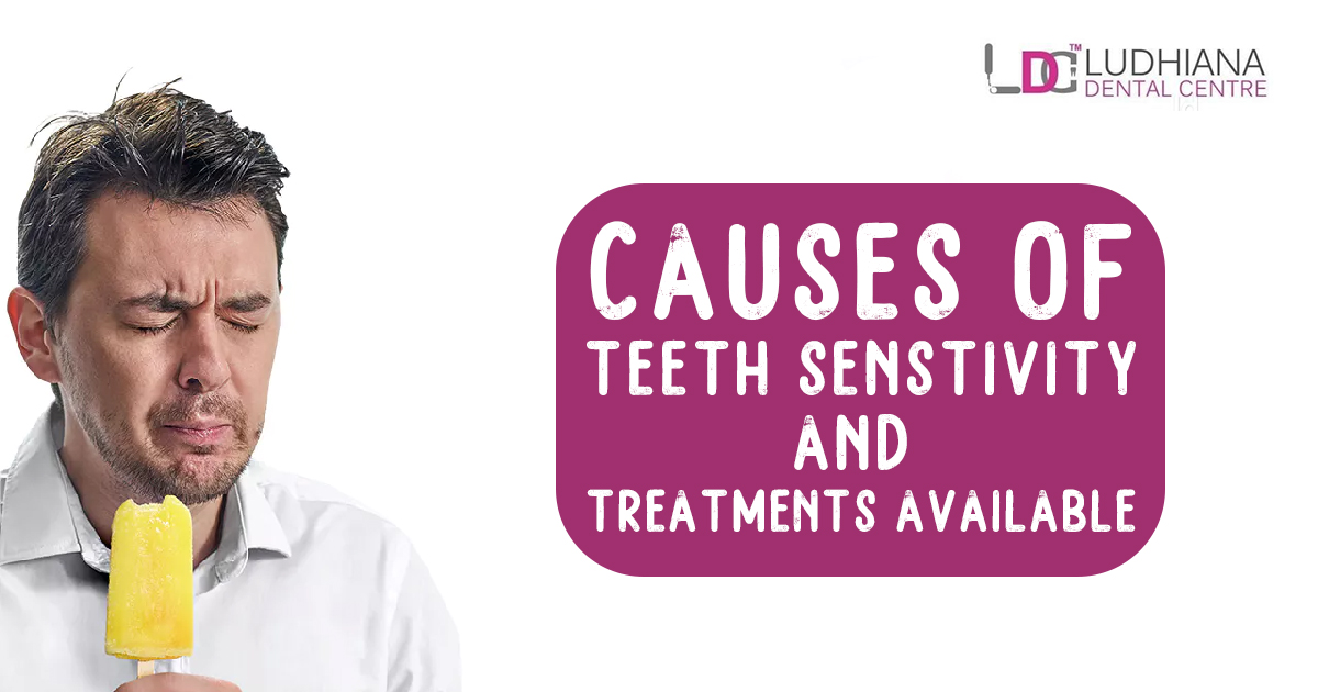 Causes Of Teeth Sensitivity And Treatments Available