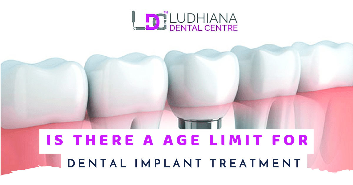 Is There A Age Limit For Dental Implant Treatment