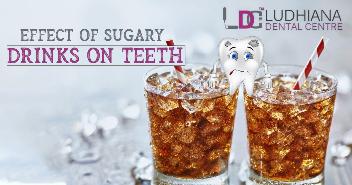 Effect Of Sugary Drinks On Teeth
