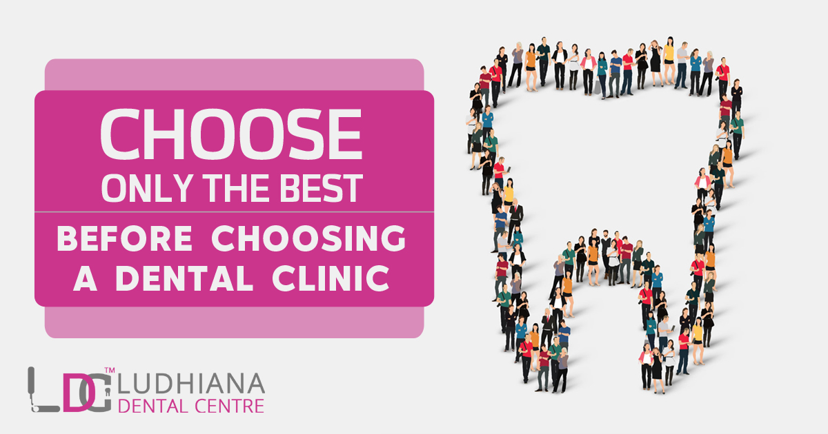 Choose Only The Best Before Choosing A Dental Clinic