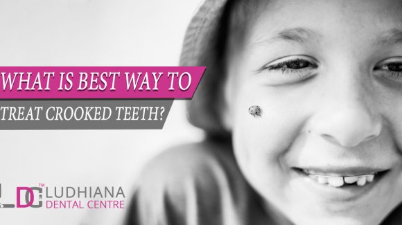 What is Best Way to Treat Crooked Teeth?
