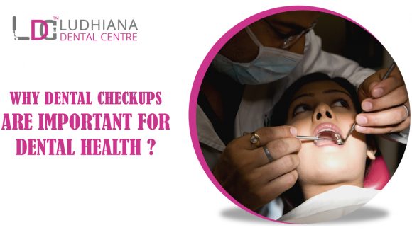Why Dental Checkups Are Important for Dental Health