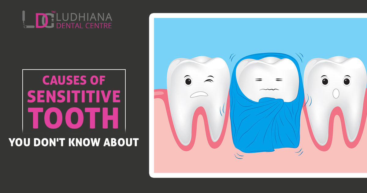 Causes of Sensitive Teeth You Don’t Know About