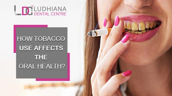 How tobacco use affects the oral health?