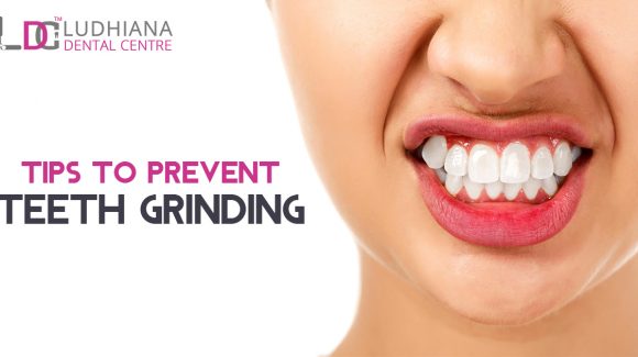 Tips To Prevent Teeth Grinding