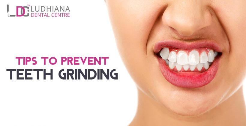 Tips To Prevent Teeth Grinding