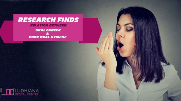 Research Finds relation between oral cancer and poor oral hygiene