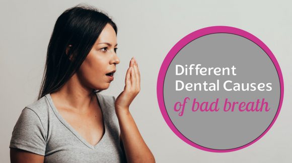 Different dental causes of bad breath
