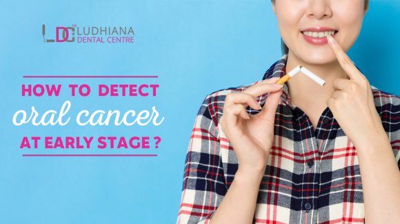 How to detect oral cancer at an early stage?