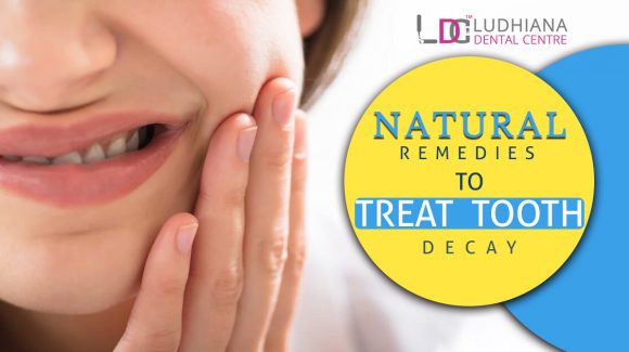 Natural remedies to treat tooth decay