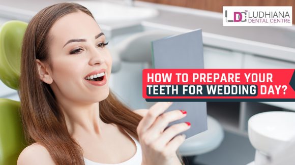 How to prepare your teeth for the wedding day?