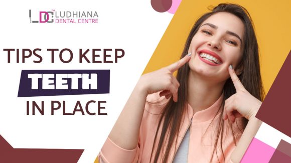 Tips to keep Teeth in Place