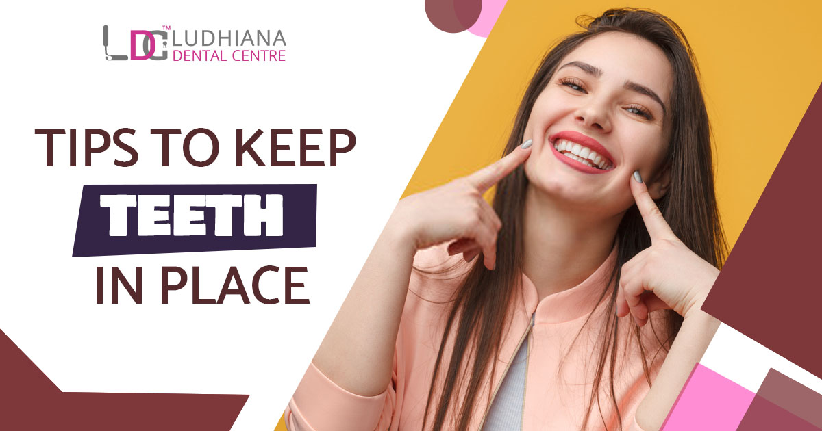 Tips to keep Teeth in Place